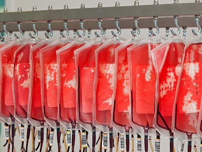 Blutkonserven von Blutspendern im Blutlabor.