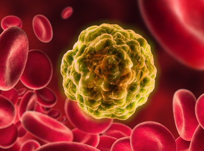 Krebszelle mit Blutkörperchen